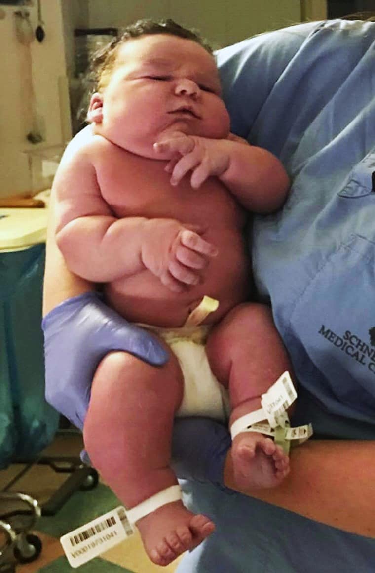 The baby born in India has a world record weight of 13kg, making viewers mistaken for photoshop