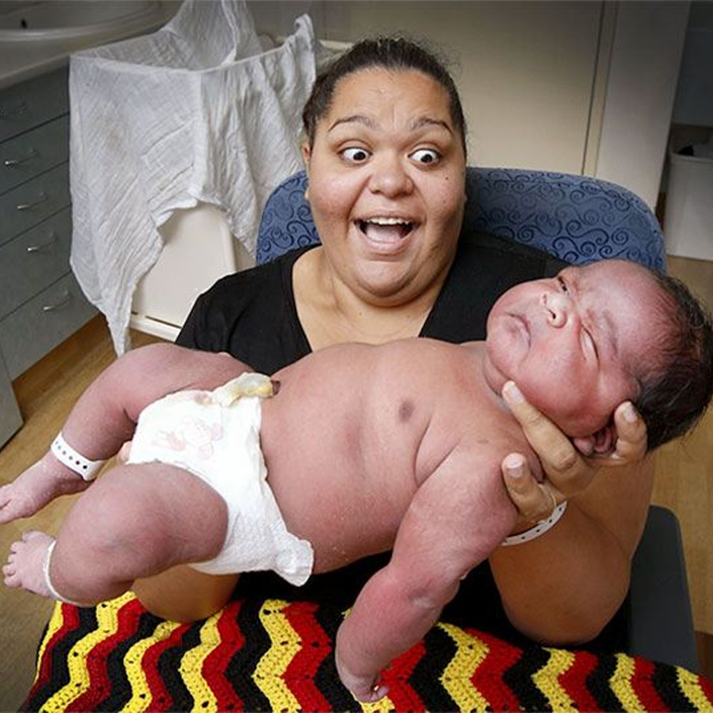 The baby born in India has a world record weight of 13kg, making viewers mistaken for photoshop